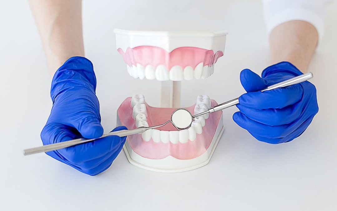 Odontoiatria conservativa: trattamenti per la carie, la frattura dei denti e altre lesioni