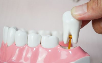 Quando è necessaria l’estrazione del dente